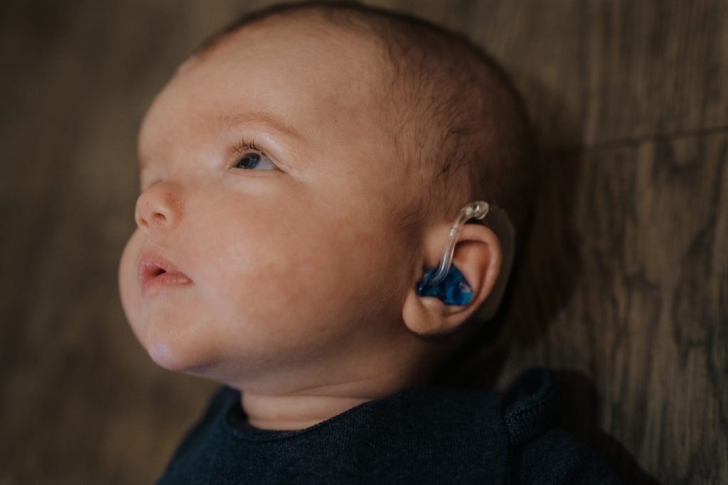 A baby with a hearing aid gazes thoughtfully upward in this children's book about disabilities.